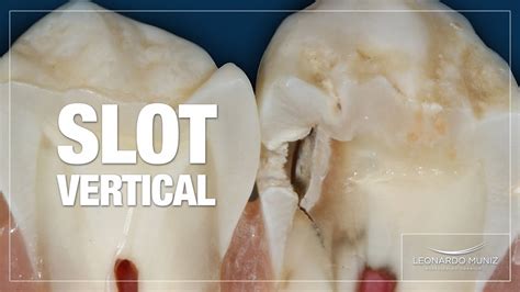 Slot De Odontologia